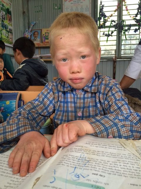 opération oculaire enfant vietnam
